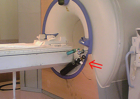 MRI検査とインプラント｜MRI装置にボンベが吸着した事例